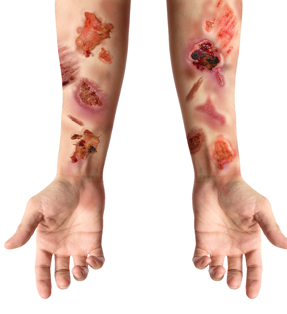 Plaktattoo geïnfecteerde wonden 30 x 13 cm - foto 4